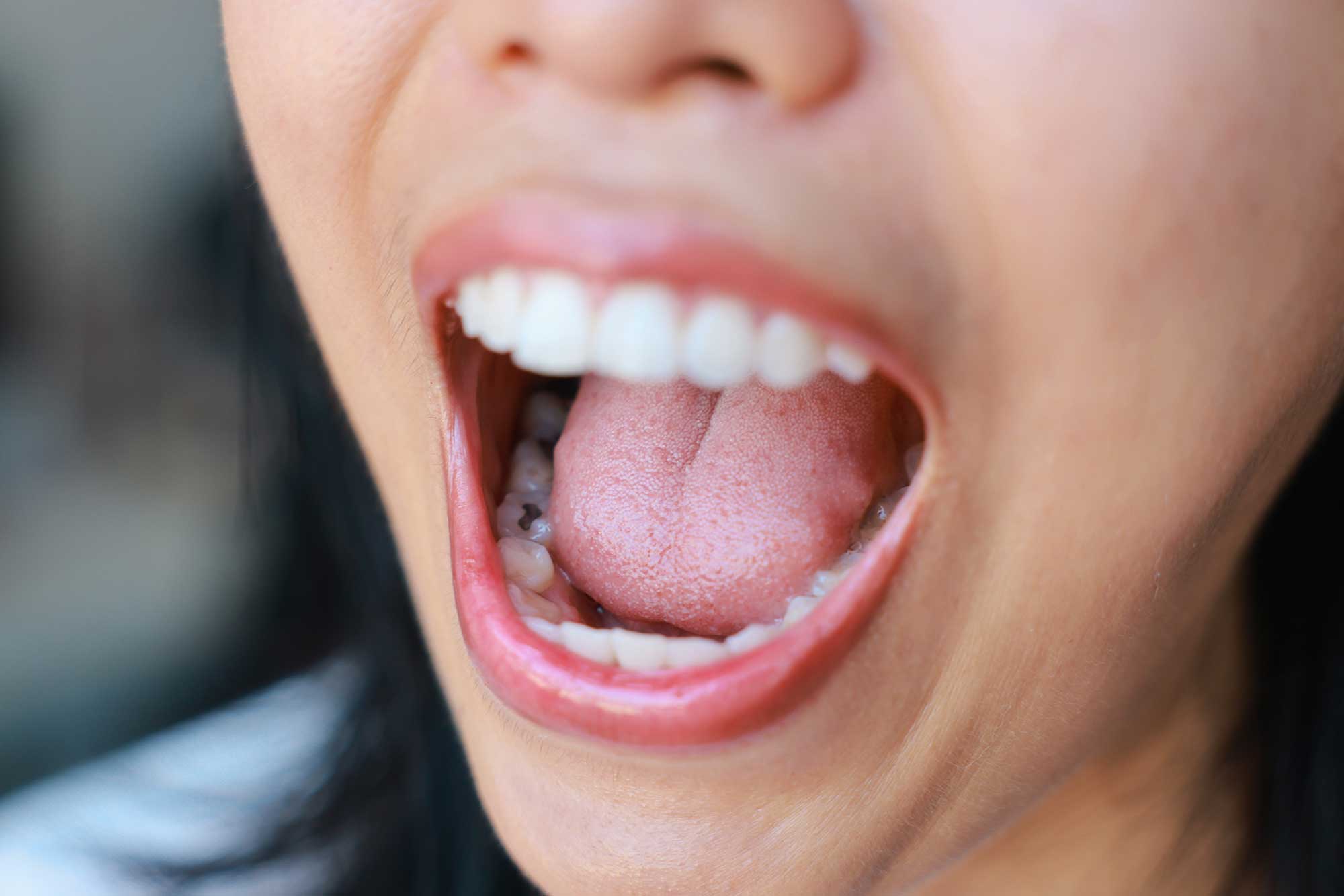 Frequent Mouth Dryness - Support Moisture With Better Habits